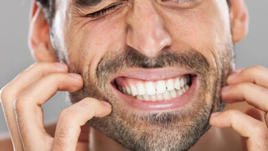 جلوگیری از خارش ریش